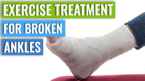 Broken Foot Treatment