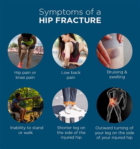 Broken Hip Symptoms Explained