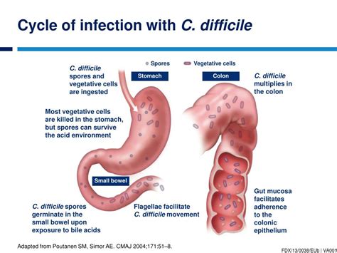 C. Diff Infections