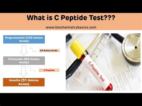 C Peptide Testing and Diagnosis