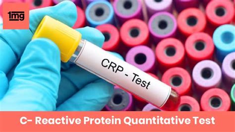 C Reactive Protein Quant Test Cancer
