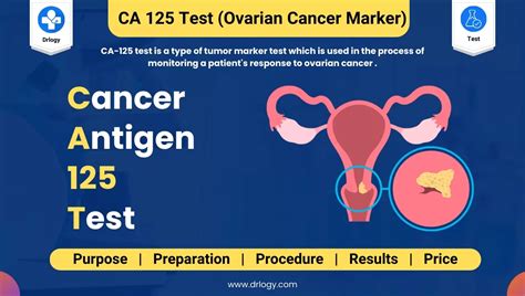 CA-125 benefits