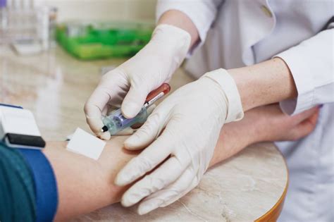 CA Blood Test Procedure