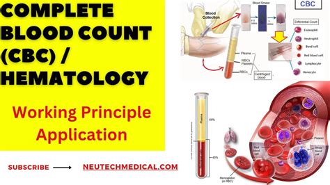 CBC Test Conclusion