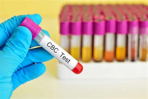 CBC Test Future