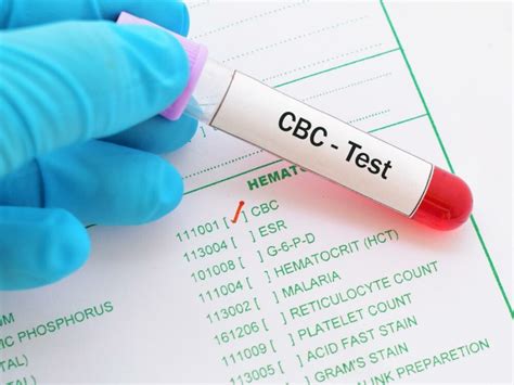 CBC Test Preparation