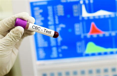 CBC Test Preventive Care