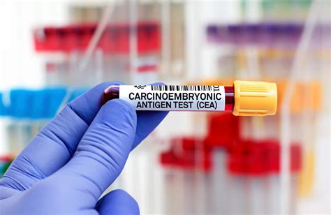 CEA Blood Count Next Steps