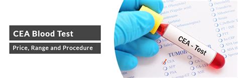 CEA Blood Test Diagnostic Tools