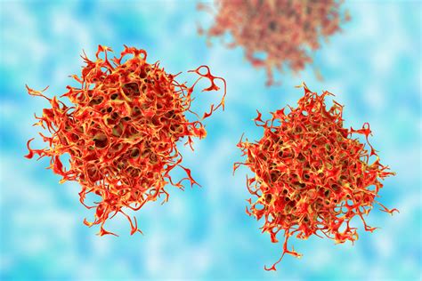 CEA Cancer Diagnosis