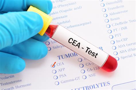CEA Colorectal Cancer