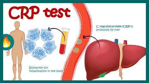CRP Inflammation