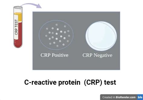 CRP Lab Test
