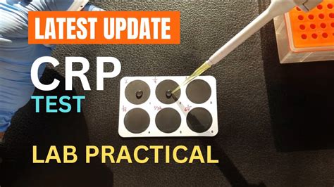 CRP Test