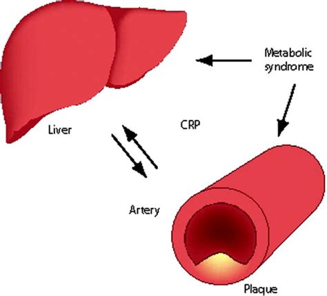 CRP and Cardiovascular Disease