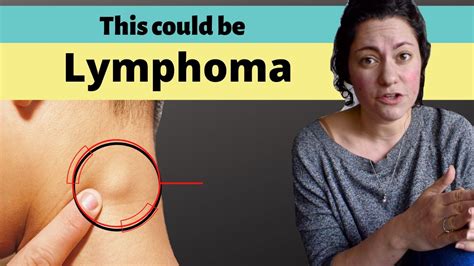 Cancer and Lymph Node Swelling