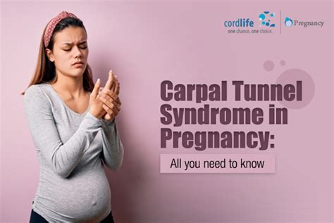 Carpal Tunnel Syndrome and Pregnancy Complications