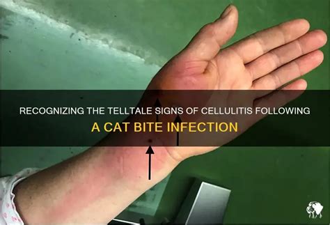 Cat Bite Infection Symptoms