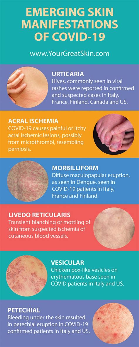 Causes and Mechanisms of Covid Rash