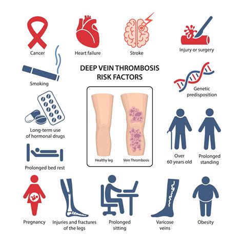 Causes and Risk Factors of Deep Thrombosis