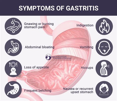 Causes and Symptoms of Gastritis