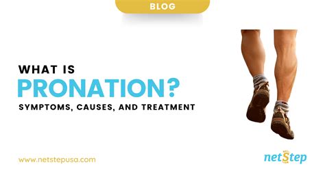 Causes and Symptoms of Pronation