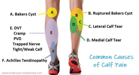 Causes of Calf Discomfort
