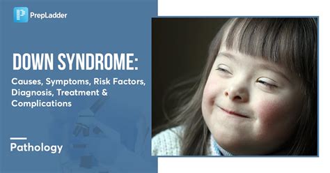 Causes of Down Syndrome