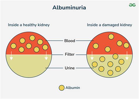 Causes of Elevated Albumin Urine Levels