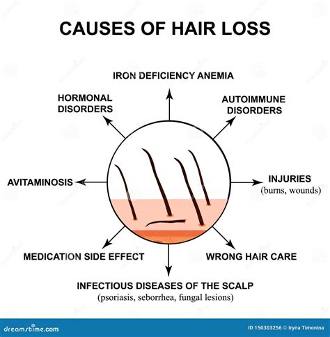 Causes of Hair Loss