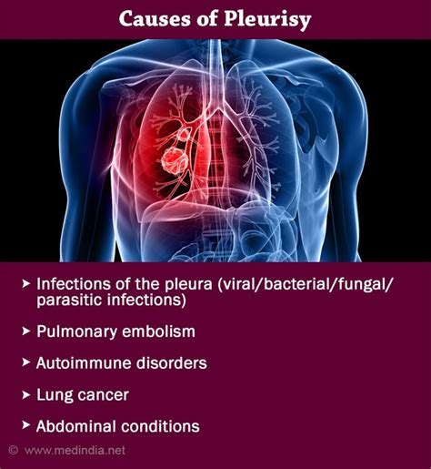 Causes of Pleuritis