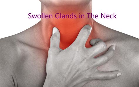 Causes of Throat Gland Swelling