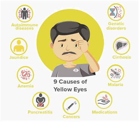 Causes of Yellow Skin and Eyes