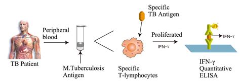 Challenges and Limitations of Igra Tb Test