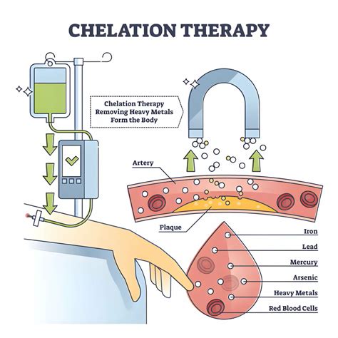 Chelation Therapy