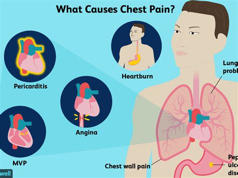 Chest Pain or Discomfort