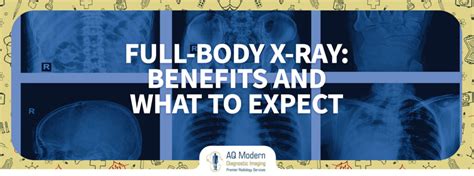 Benefits of Chest X-Ray