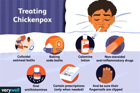 Chickenpox Treatments