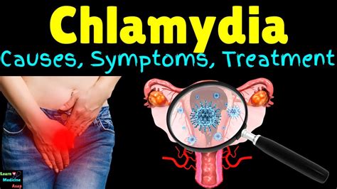 Chlamydia Complications