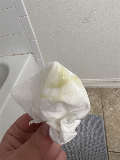 Chlamydia discharge