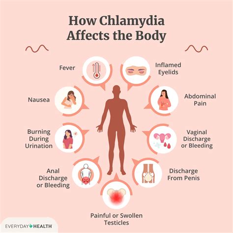 Chlamydia discharge causes