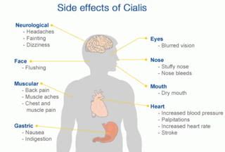 Cialis Side Effects
