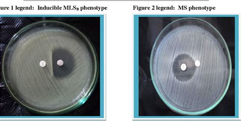 Clindamycin Resistance