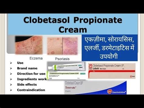 Clobetasol Propionate Cream Working Mechanism