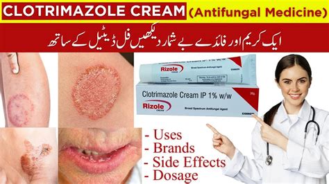 Clotrimazole Antifungal Cream Benefits
