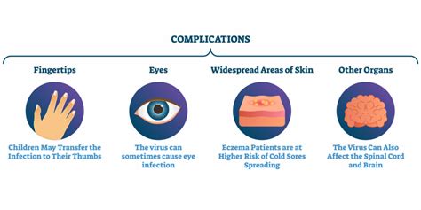 Cold Sore Complications