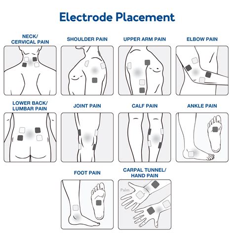 Common Applications of TENS Units