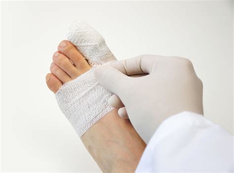 Common Complications Broken Toe Care