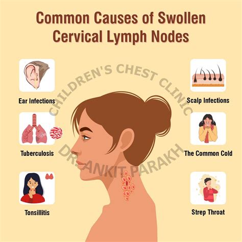 Common Conditions Affecting Neck Lymph Nodes