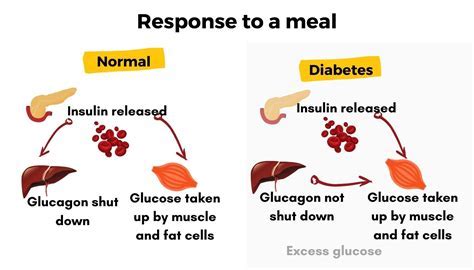 Common Mistakes That Can Disrupt Glucose Levels